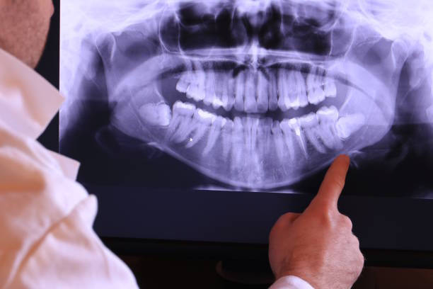 Best Emergency Dental Surgery in West Point, KY