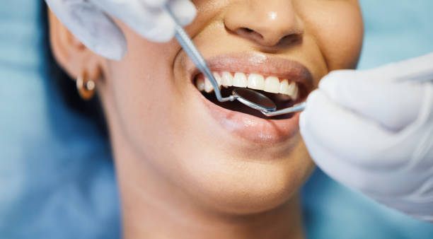 Best Emergency Tooth Extraction in West Point, KY
